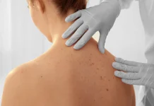 The Skin-Cancer Epidemic Australia Can’t Ignore
